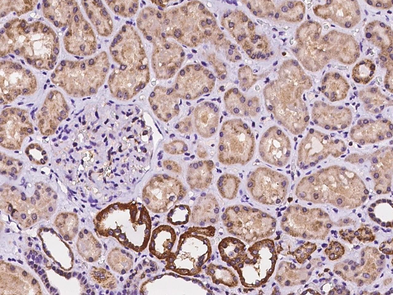 ARL6 Antibody