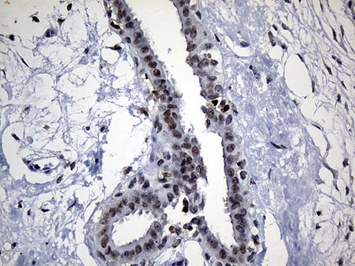 ELL / MEN Antibody (aa302-621, clone OTI5E12)