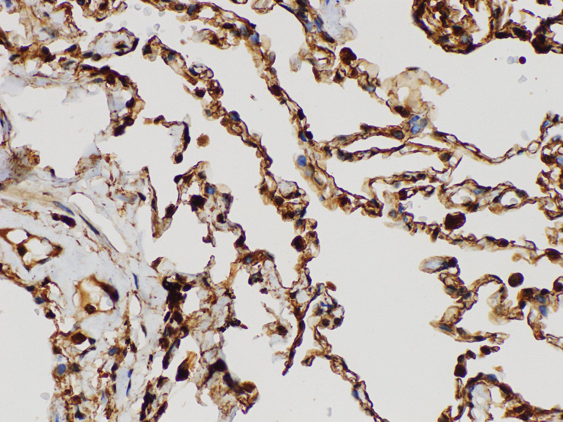 S100A4 / FSP1 Antibody