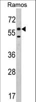 Polyclonal Rabbit anti-Human ETFDH Antibody (aa32-61, IHC, WB)