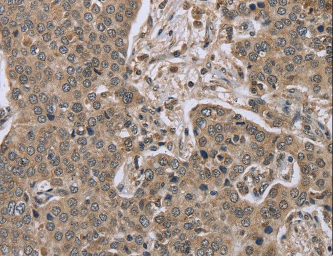 IL15RA Antibody