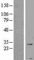 PNPLA4 Protein (Over-Expression Lysate Myc-DDK (Flag))