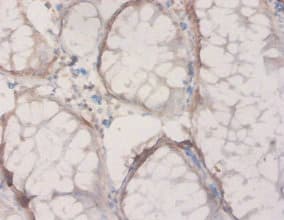 HPD Antibody