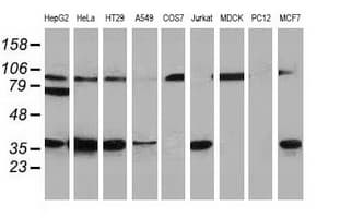 RTFDC1 Antibody (clone OTI1E8)