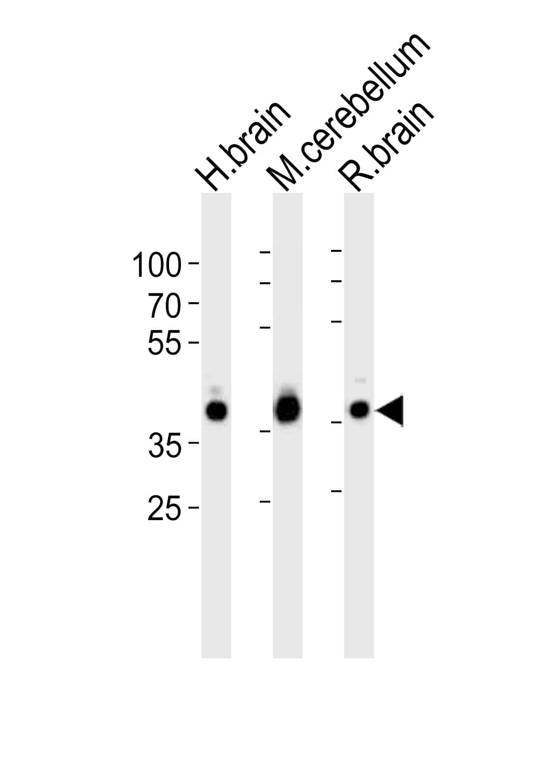 PathPlus™ ALDOC / Aldolase C Antibody (aa300-333)