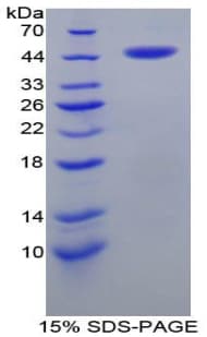 Human CRH / CRF Protein (Recombinant His-GST)