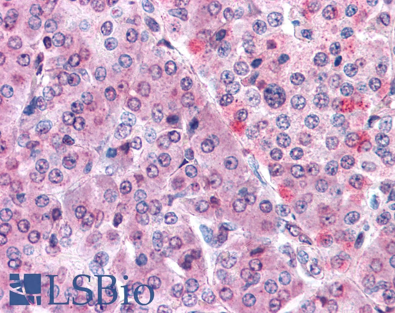 IHC-plus™ KIAA0152 / MLEC Antibody (Internal)