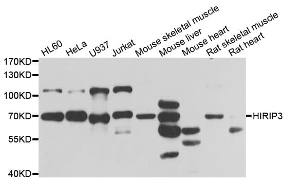 Polyclonal Rabbit anti-Human HIRIP3 Antibody (IHC, IF, WB)