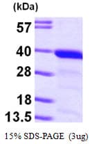Human GGPS1 Protein (Recombinant His)