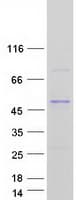 Human UGT2B10 Protein (Recombinant Myc-DDK (Flag))