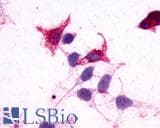 PathPlus™ Polyclonal Rabbit anti-Human GPR182 / ADMR Antibody (N-Terminus, IHC, WB)