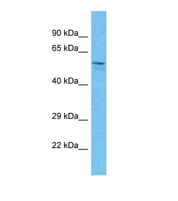 Polyclonal Rabbit anti-Human SIX4 Antibody (aa224-273, WB)