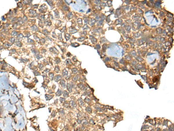 Polyclonal Rabbit anti-Human CCDC113 Antibody (IHC)