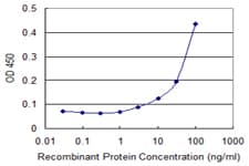 Monoclonal Mouse anti-Human TLR2 Antibody (clone 2G9, WB)