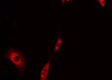 Polyclonal Rabbit anti-Human MRPS30 Antibody (IF, WB)