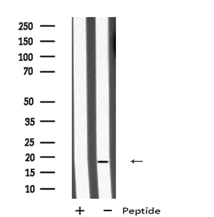 MID1IP1 Antibody