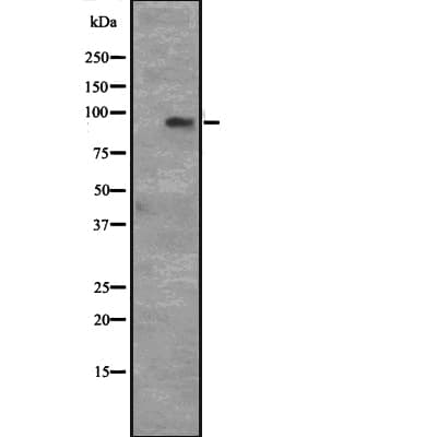 Polyclonal Rabbit anti-Human CCNT1 / Cyclin T1 Antibody (IHC, WB)