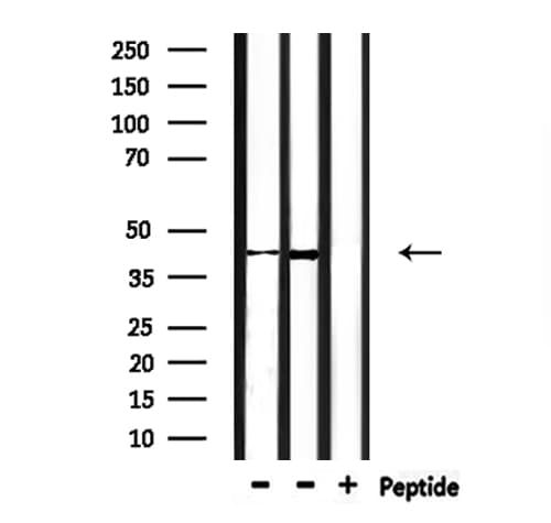 CHST14 Antibody