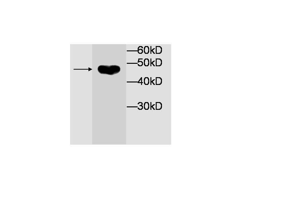 IHC-plus™ CYB5A / Cytochrome b5 Antibody