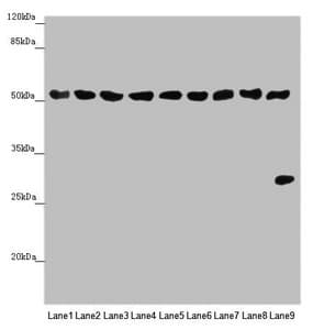 Polyclonal Rabbit anti-Human SAMM50 Antibody (IHC, WB)