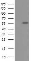 TP53 / p53 Antibody (clone OTI2C4)