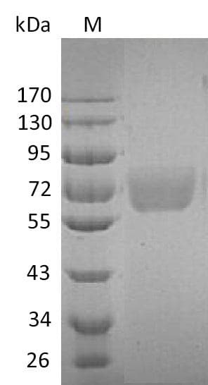 Human IL4R / CD124 Protein (Recombinant Fc, C-terminus)