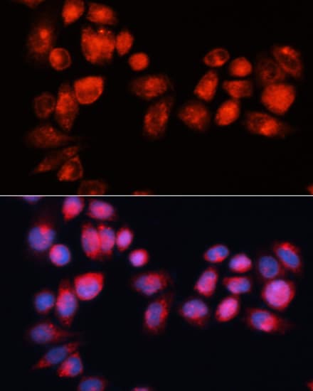 ABCB7 Antibody