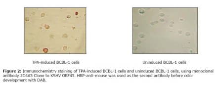 HHV-8 ORF45 Antibody (clone 2D4A5)