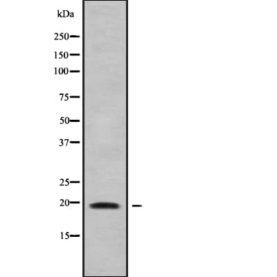 Polyclonal Rabbit anti-Human CMTM7 / CKLFSF7 Antibody (IHC, WB)