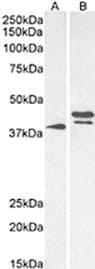 GHSR / Ghrelin Receptor Antibody