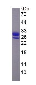 Human RBP4 Protein (Recombinant)