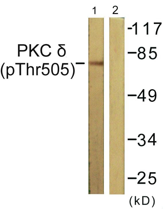 PRKCD / PKC-Delta Antibody (phospho-Thr505)