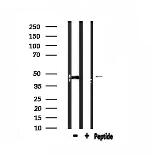 IGSF4C / CADM4 Antibody