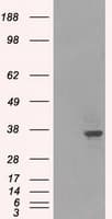 LDHA / LDH1 Antibody (clone OTI2B11)
