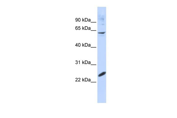 SMAD4 Antibody (N-Terminus)