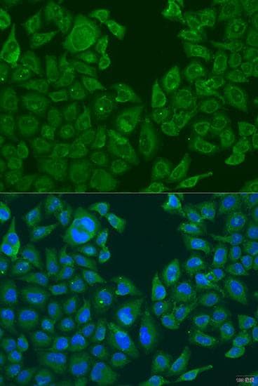 NLRP2 / NALP2 Antibody