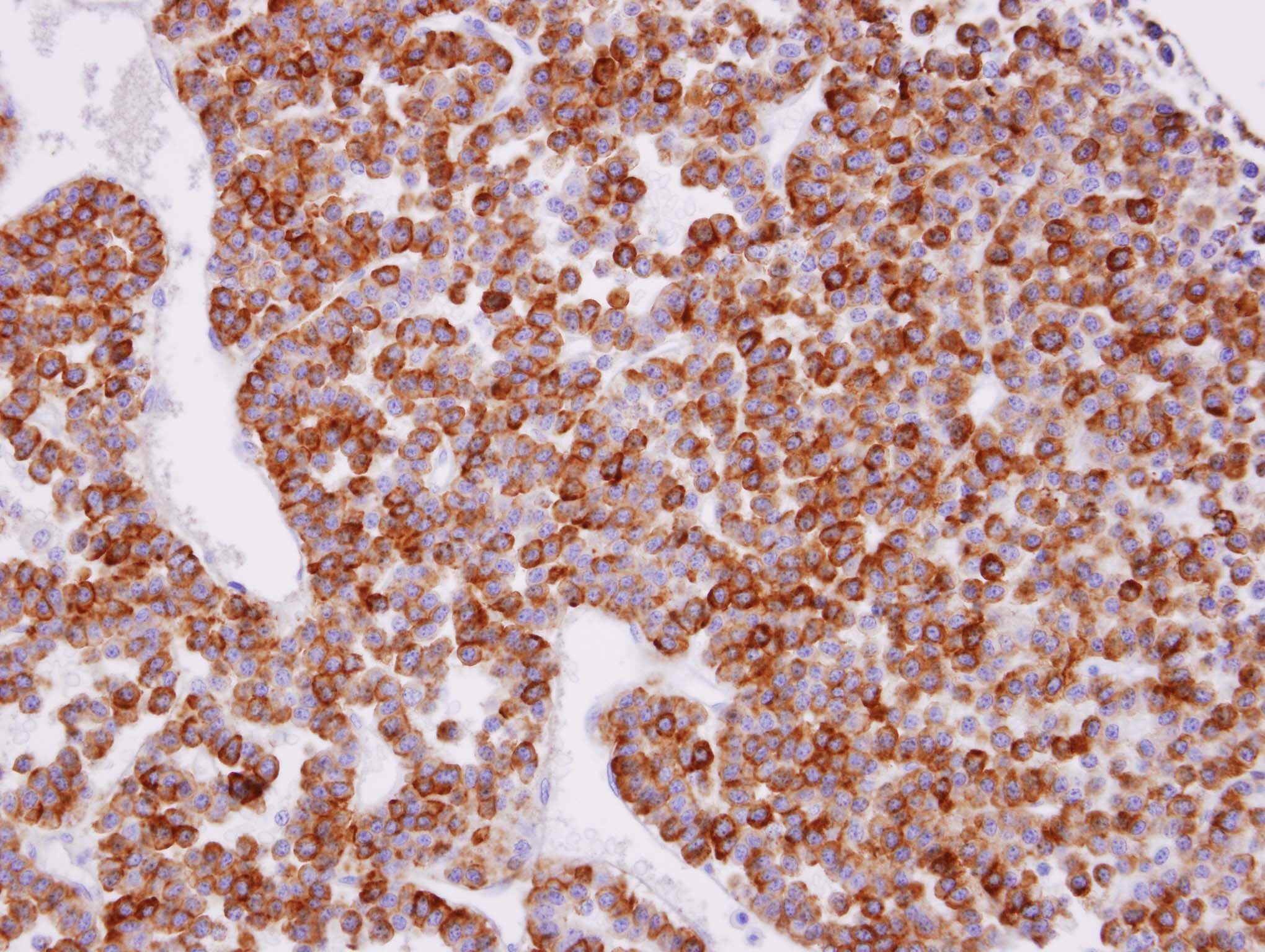 XPR1 Antibody (aa1-45)