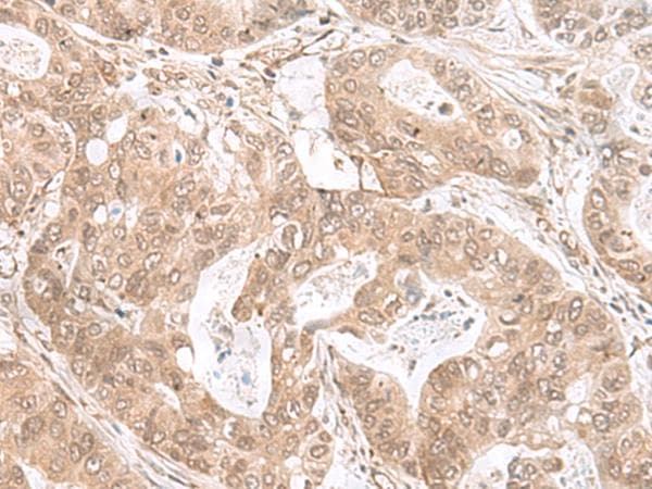 ETV3 Antibody