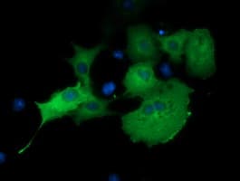 MTMR14 Antibody (clone OTI7B2, Carrier-free)