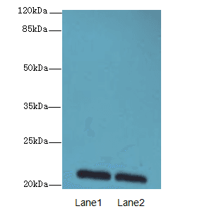 EPO / Erythropoietin Antibody