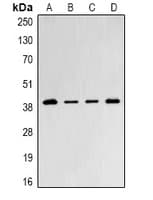 PSMD8 / RPN12 Antibody