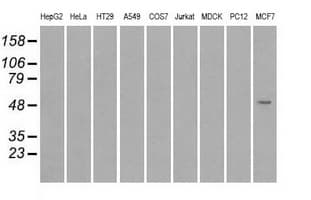 SLC2A5 / GLUT5 Antibody (clone OTI2C4)