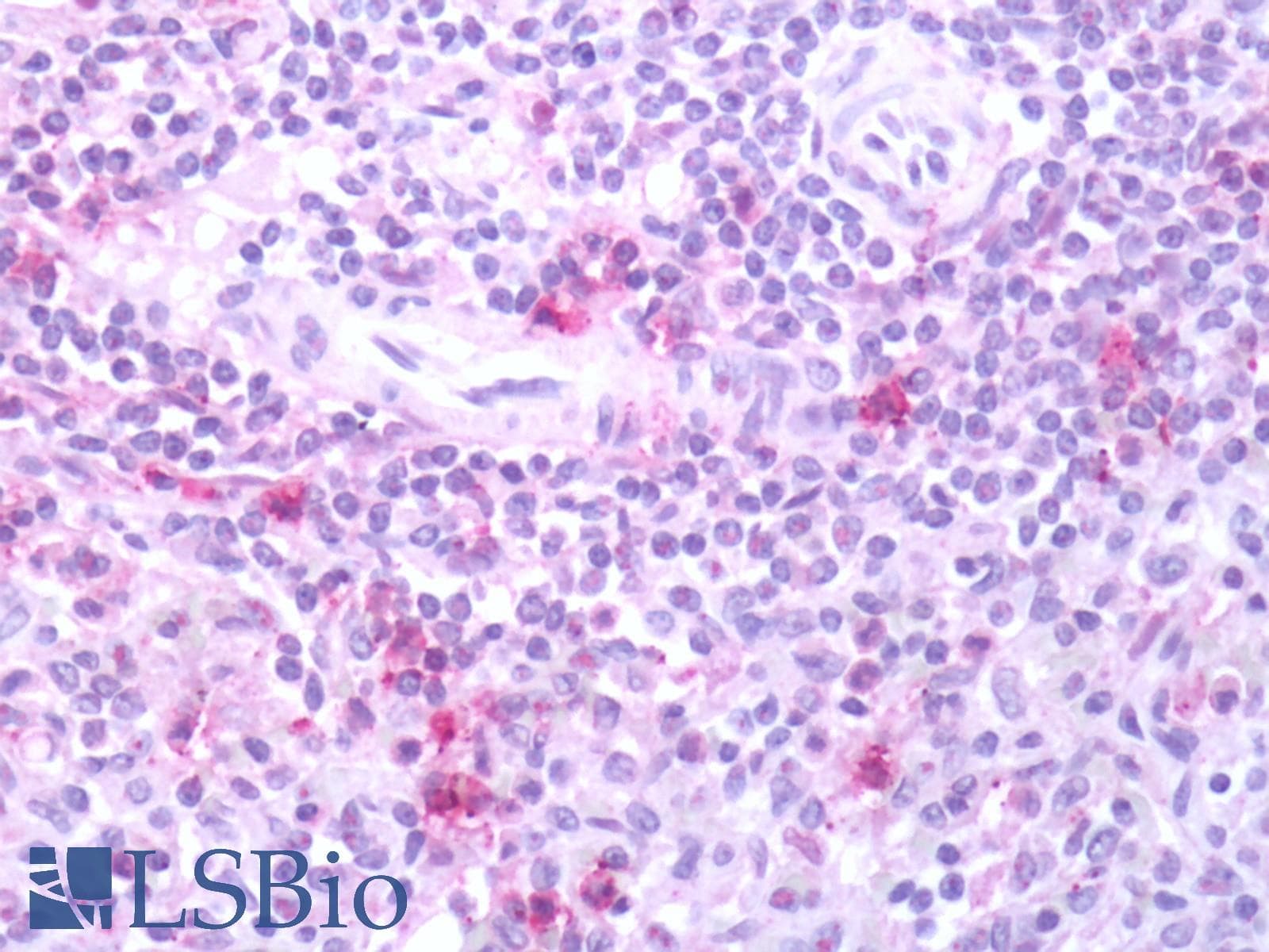 PathPlus™ FPR2 / FPRL1 Antibody (C-Terminus)