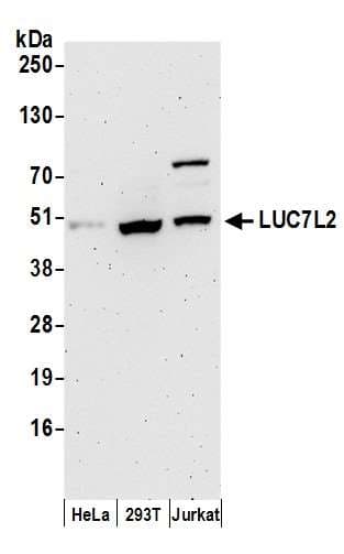 Polyclonal Rabbit anti-Human LUC7L2 Antibody (aa340-390, WB)