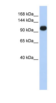 Polyclonal Rabbit anti-Human ATP2A3 / SERCA3 Antibody (aa828-877, WB)
