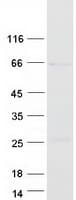 Human METTL14 Protein (Recombinant Myc-DDK (Flag))