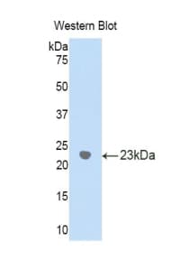 GGT1 / GGT Antibody (aa122-299)