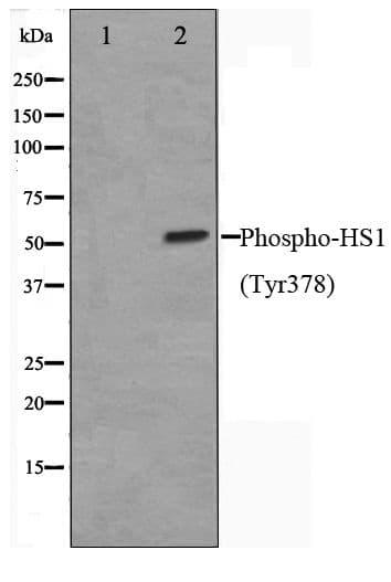 Polyclonal Rabbit anti-Human HCLS1 Antibody (phospho-Tyr378, WB)