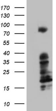 Monoclonal Mouse anti-Human BCL6 Antibody (clone OTI20A3, aa1-300, WB)