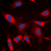 NCF1 / p47phox / p47 phox Antibody (C-Terminus)